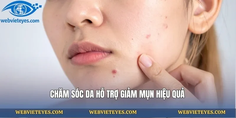 Chăm sóc da hỗ trợ giảm mụn hiệu quả