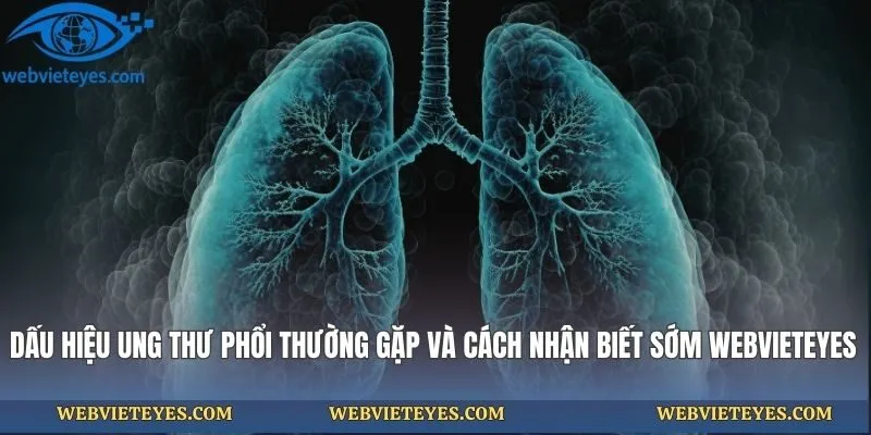 Dấu Hiệu Ung Thư Phổi Thường Gặp