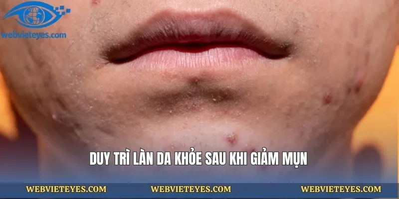 Duy trì làn da khỏe sau khi giảm mụn